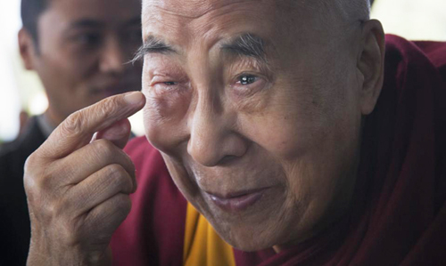 Tibetan spiritual leader the Dalai Lama points to his swollen right eye as he talks to journalists before boarding his chartered flight in Dharmsala, India, Tuesday, Jan. 19, 2016. The Tibetan leader said that he was going to the Mayo Clinic in Rochester, N.Y., for a regular medical checkup. (AP Photo/Ashwini Bhatia)