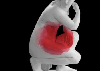 Women often find their pain symptoms being dismissed (Credit: BBC/Alamy)
