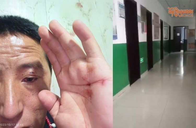 བོད་ཀྱི་ཆབ་སྲིད་བཙོན་ཟུར་བཀྲ་ཤིས་དབང་ཕྱུག་ལགས་ལ་གཅར་རྡུང་བཏང་བ། པར་བོད་ནས་འདི་གར་མཁོ་སྤྲོད་བྱས། ༢༠༢༣།༡༠།༡༧