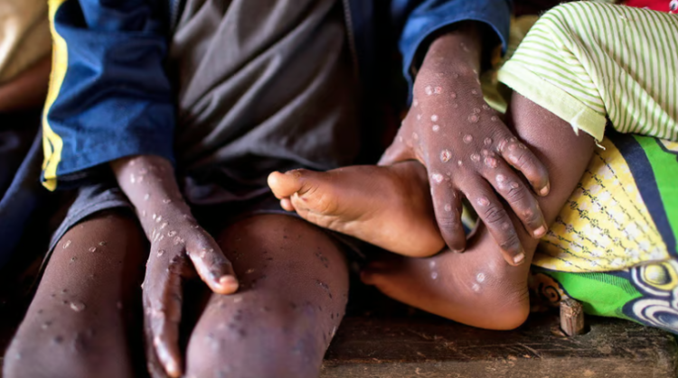 WHO declares mpox a global public health emergency for second time in two years. photograph: Panos