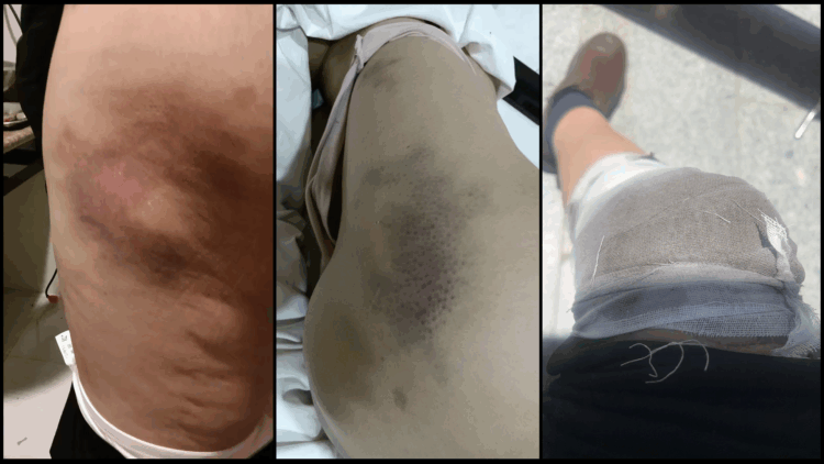 མགོན་པོ་སྐྱིད་ལགས་ཀྱིས་ཆབ་སྲིད་བཙོན་པ་རྡོ་རྗེ་བཀྲ་ཤིས་ཀྱི་ཆེད་དུ་ཞི་བའི་ལས་འགུལ་སྤེལ་བར་རྒྱ་གཞུང་གིས་བཀག་ཉར་འོག་དམ་དྲག་བྱས་རྐྱེན། བསྐྱར་དུ་ཐོག་ཁང་ནས་མར་མཆོངས་ཏེ་རང་སྲོག་བློས་གཏོང་བྱེད་རྩིས་བྱས། བོད་ཀྱི་དུས་བབ་ཀྱིས་པར་བསྒྲིགས།